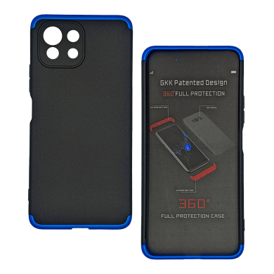 GKK 360 Full Body Protection Xiaomi Mi 11 Lite 4G / Mi 11 Lite 5G Μαύρο/Μπλε